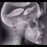 FishBrain